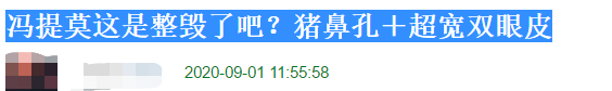 冯提莫近况差？鼻孔朝天眼皮变宽被疑整容过度，转平台后收入惨淡