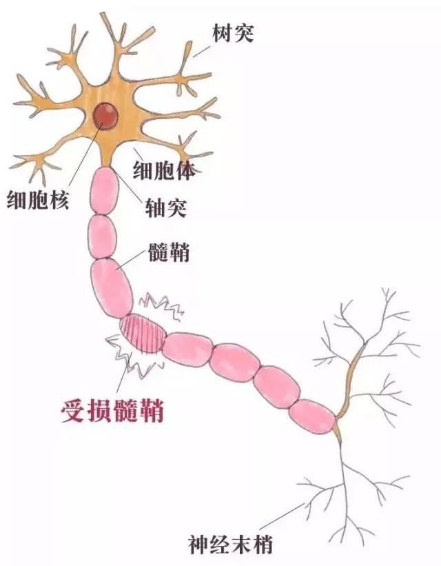 别名“美女病”，多发于年轻女性还不能根治，一定得早发现早治疗