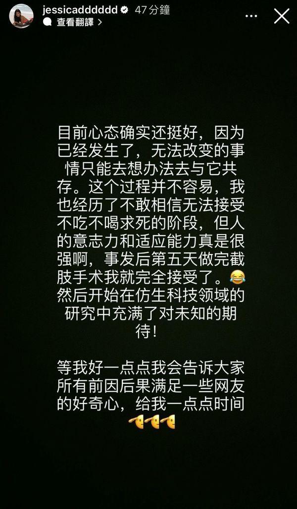 美女模特意外失去左手宣布截肢！曾患精神病，是洪天明前绯闻女友