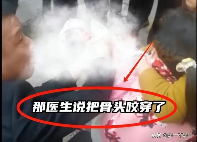 骨头都咬穿了！恶犬当街撕咬女孩，棍子打断不松口，主人跪地道歉