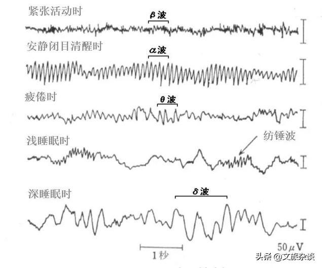 从上海科技馆的脑电波比试游戏来谈：意念控制，离我们还有多远？