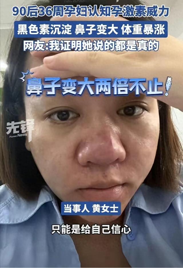 怀孕真能毁容？美女鼻子变大2倍前后对比，网友热议爱美的代价！