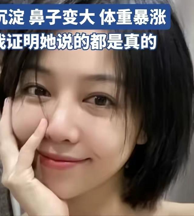 怀孕真能毁容？美女鼻子变大2倍前后对比，网友热议爱美的代价！