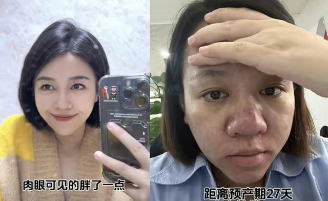 怀孕真能毁容？美女鼻子变大2倍前后对比，网友热议爱美的代价！